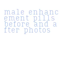male enhancement pills before and after photos