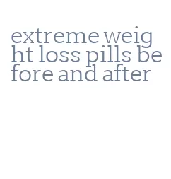 extreme weight loss pills before and after