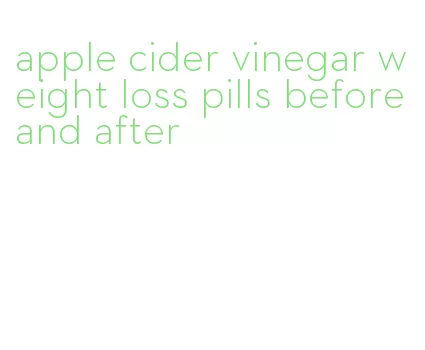 apple cider vinegar weight loss pills before and after