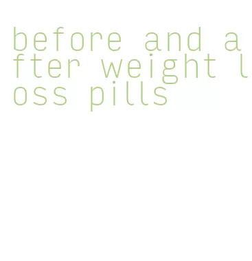 before and after weight loss pills