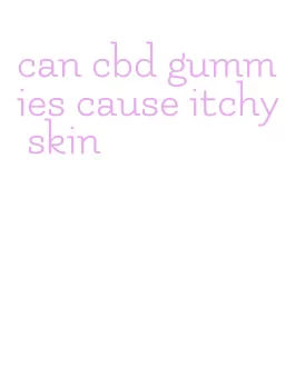 can cbd gummies cause itchy skin