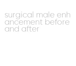 surgical male enhancement before and after