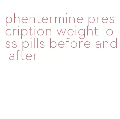 phentermine prescription weight loss pills before and after