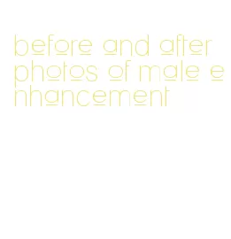 before and after photos of male enhancement