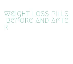 weight loss pills before and after