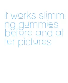 it works slimming gummies before and after pictures