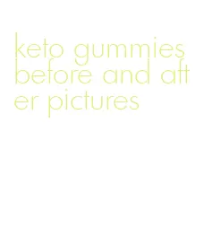 keto gummies before and after pictures