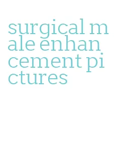 surgical male enhancement pictures